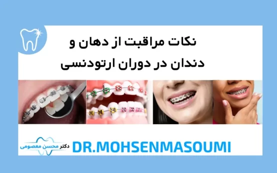 نکات مراقبت از دهان و دندان