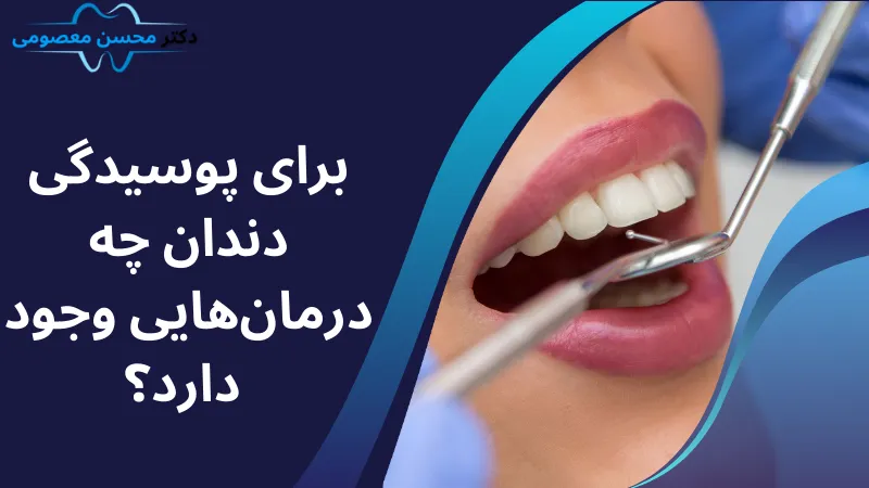 برای پوسیدگی دندان چه درمان‌هایی وجود دارد؟